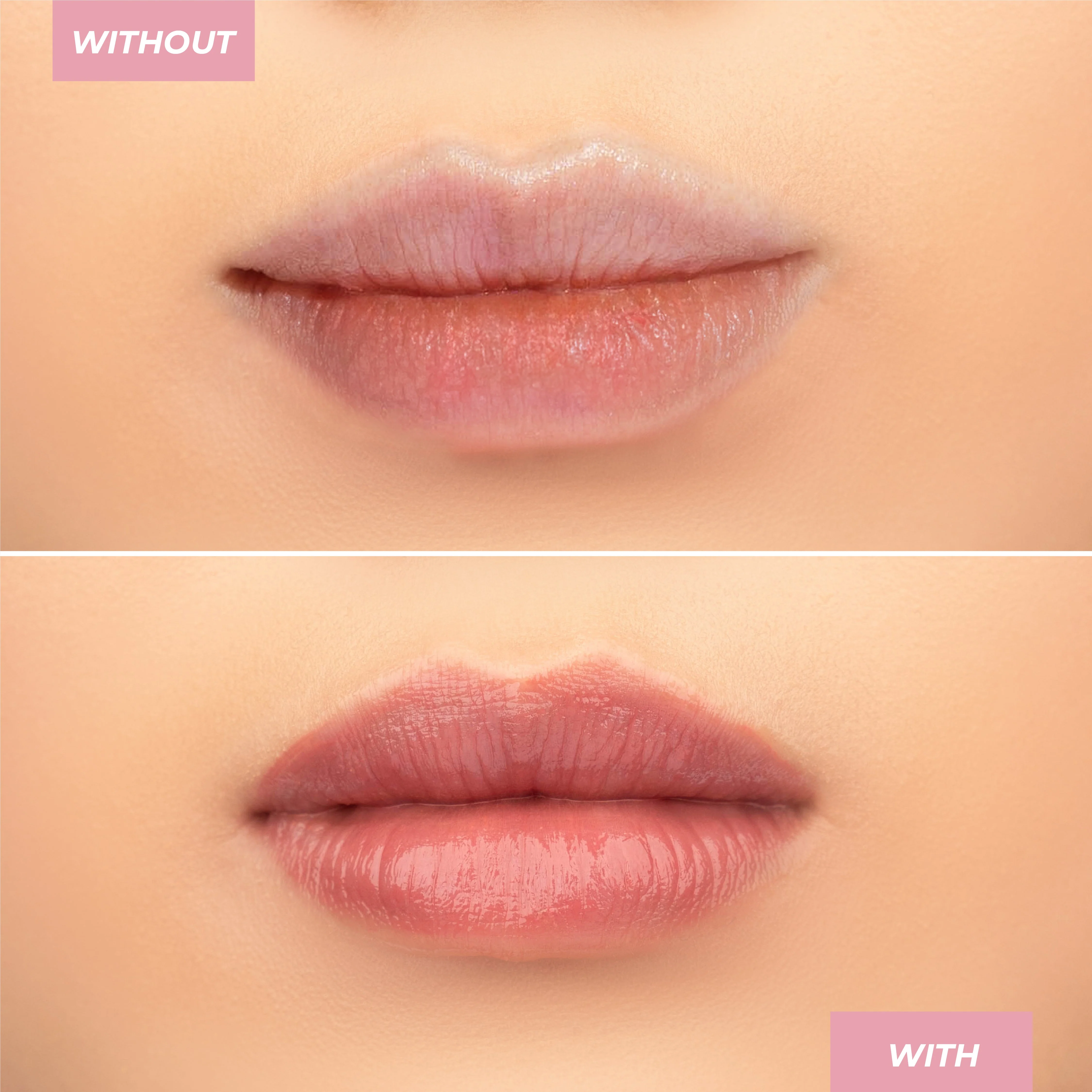 Hyaluronic Lip Balm - Image 23