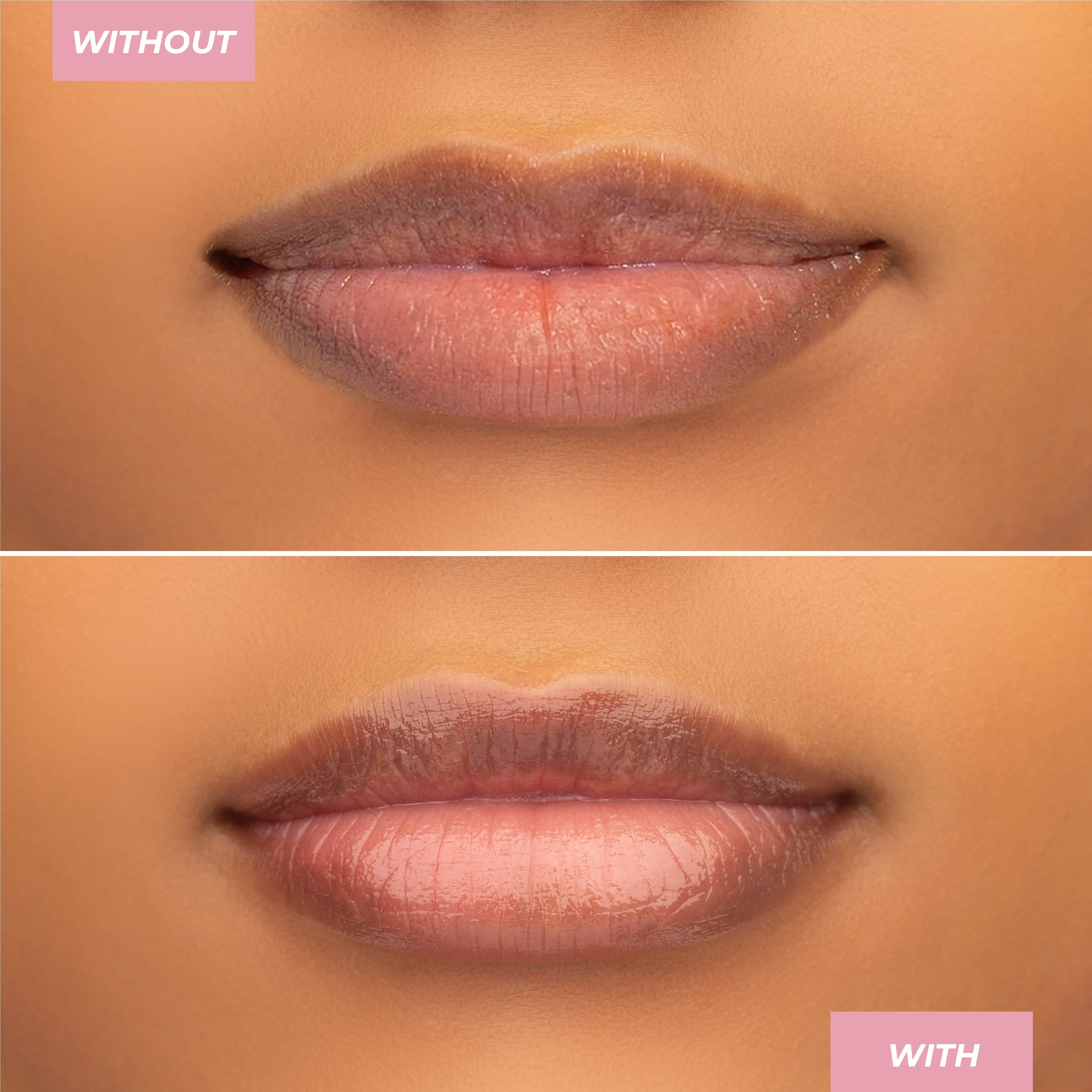 Hyaluronic Lip Balm - Image 24